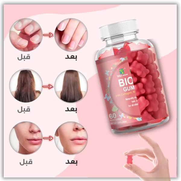 نتائج ملحوظة مع جوميز دينس